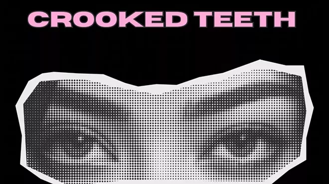 Image: Crooked Teeth